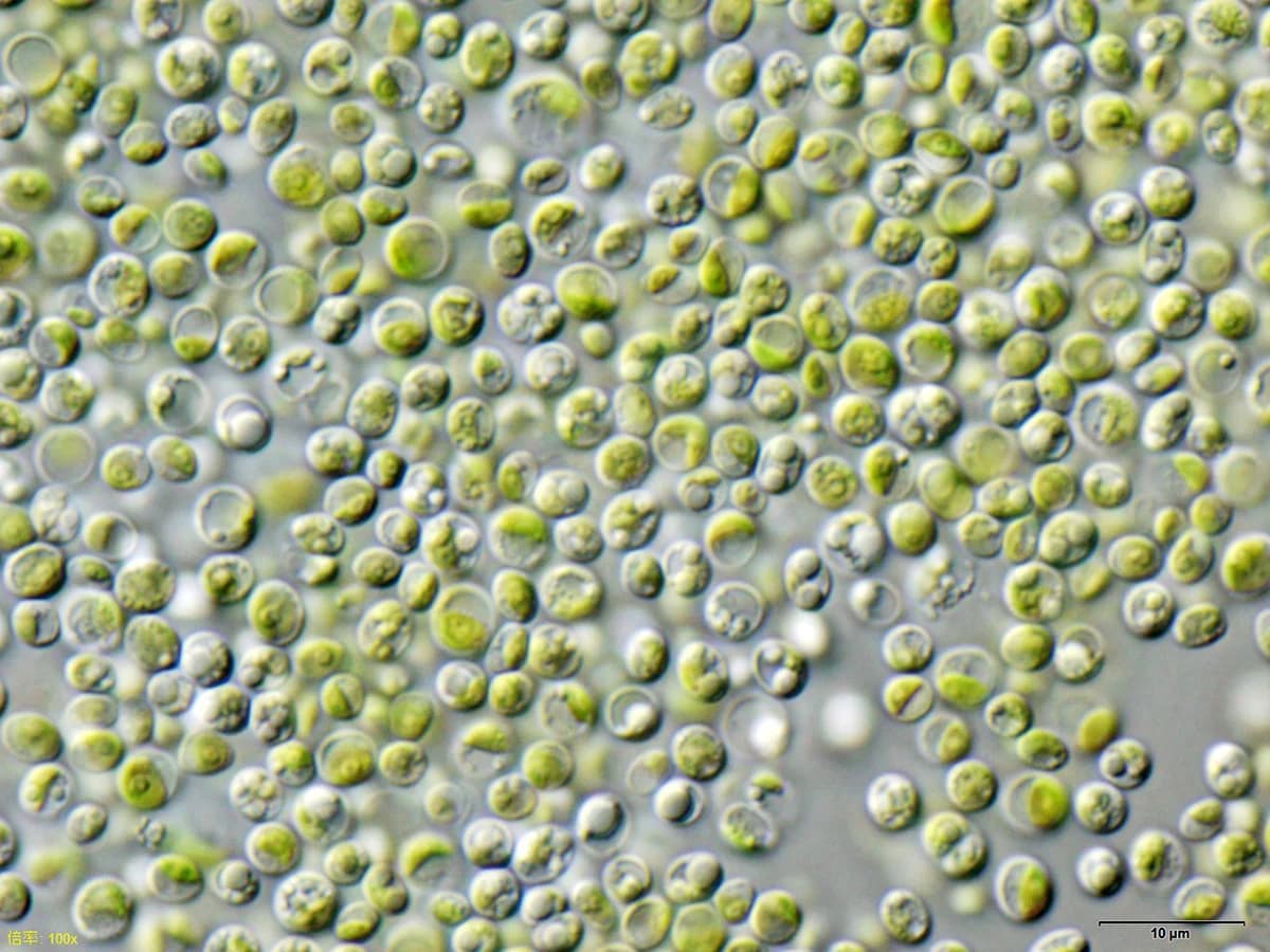 Хлорела (Chlorella vulgaris) — реална микрофотография
